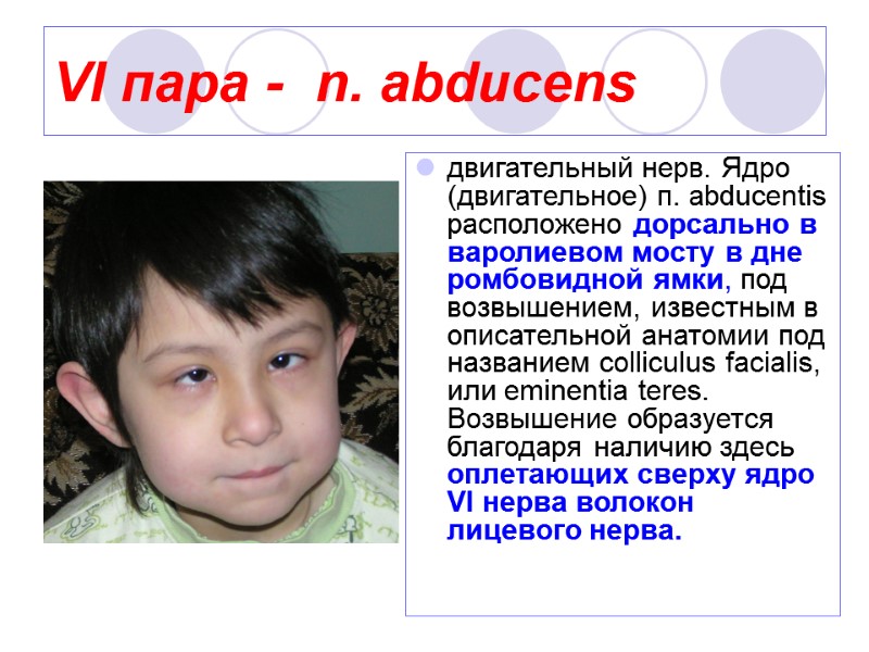 VI пара -  n. abducens  двигательный нерв. Ядро (двигательное) п. abducentis расположено